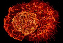 Scientists Say a Newly Discovered Immune Cell May Drive Inflammation as We Age