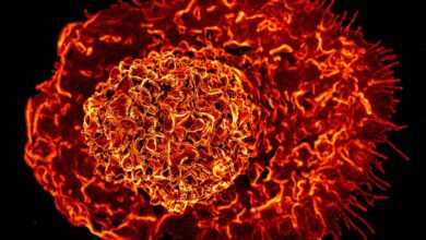 Scientists Say a Newly Discovered Immune Cell May Drive Inflammation as We Age