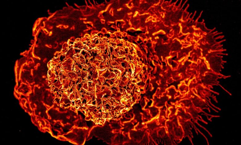 Scientists Say a Newly Discovered Immune Cell May Drive Inflammation as We Age