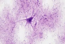 This Crawling Robot Is Made With Living Brain and Muscle Cells