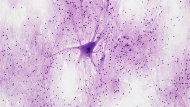 This Crawling Robot Is Made With Living Brain and Muscle Cells